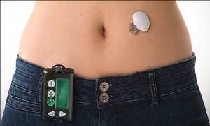 Global Artificial Pancreas Systems Market Growth