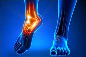Global Artificial Ankle Joint Market Size