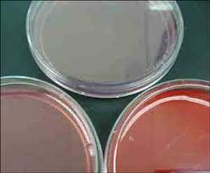 Global Microbial Growth Media Market Insights