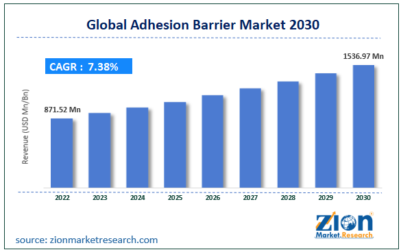 Adhesion Barrier Market Size